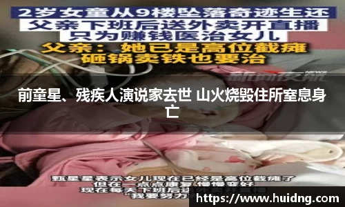 NG28前童星、残疾人演说家去世 山火烧毁住所窒息身亡